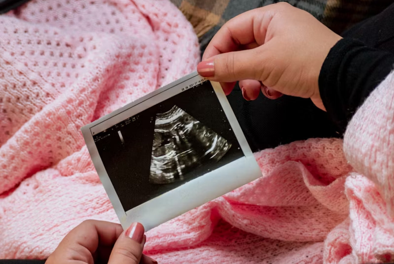 Soon to be mother looking at ultrasound image